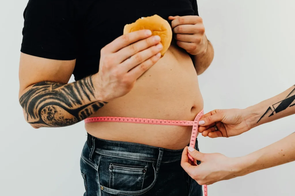 weight loss surgery