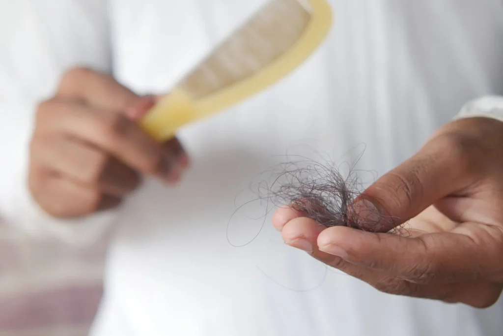 baldness treatment laser therapy
