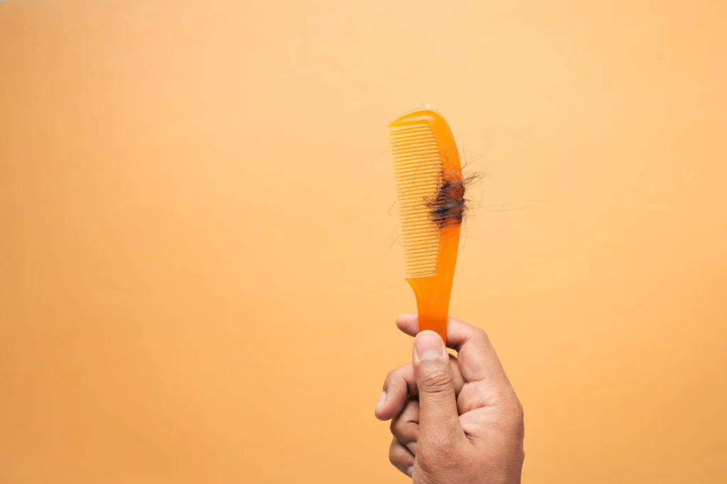 consultation for hair fall loss treatment
